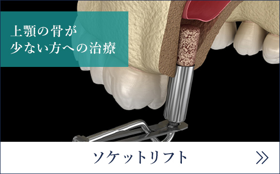 ソケットリフト