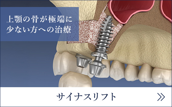 サイナスリフト