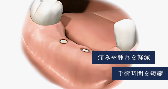 痛みや腫れを軽減手術時間を短縮